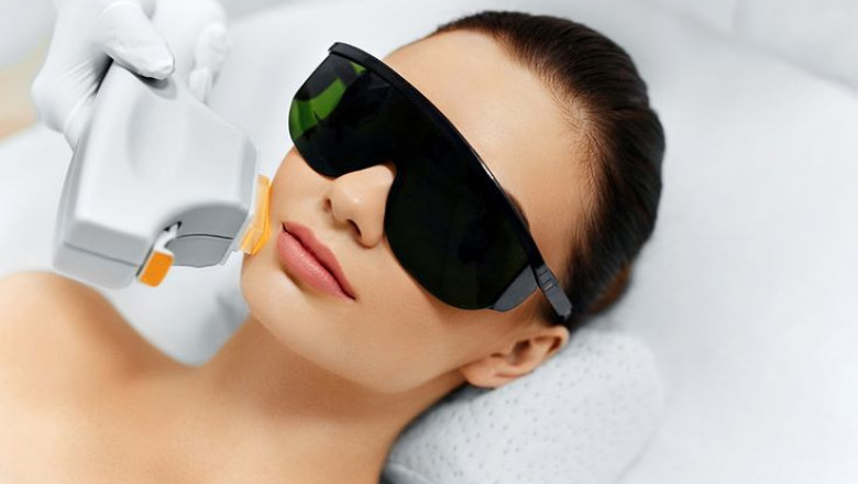 Understanding the Laser Skin Tightening Process: What to Expect in Islamabad