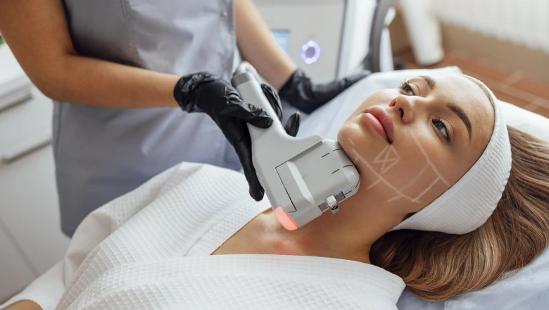 Say Yes to Firmer Skin with HIFU