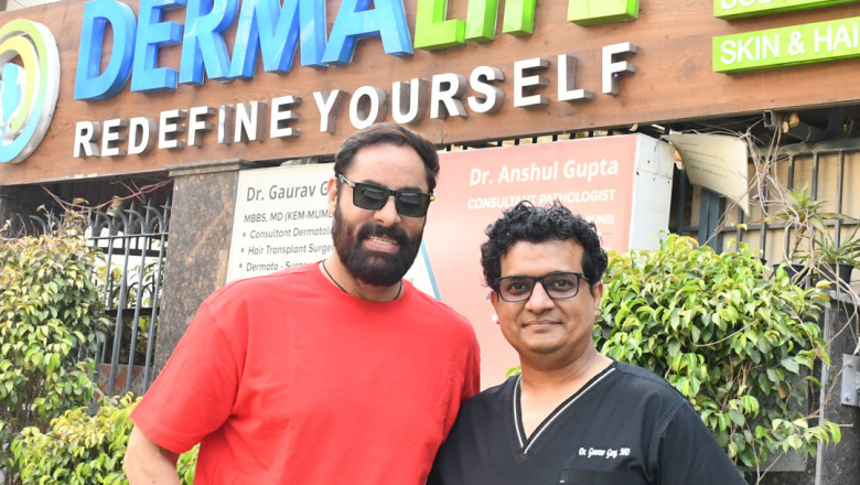 Here's Your Complete Hair Transplant Timeline in Delhi