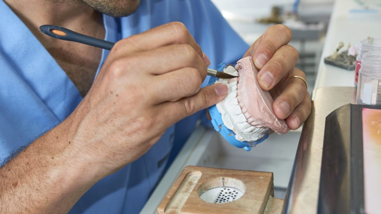 Precision in Dentistry: Ceramic Dental Lab & Dental Implant Lab