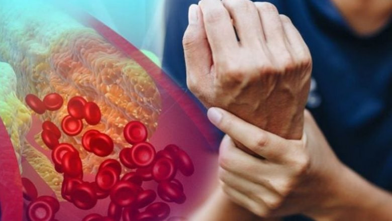 Understanding High Cholesterolemia in Dubai: Causes, Risks, and Treatments