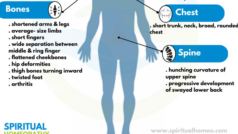 Trusted Homeo Doctor in Hyderabad for Dwarfism – Spiritual Homeopathy