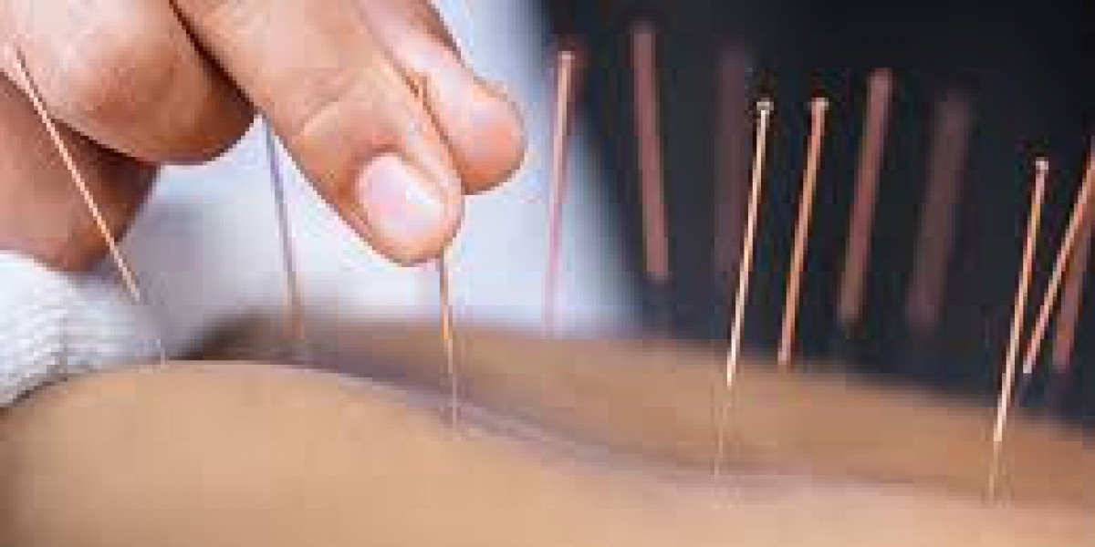 Mastering the Art of Biomagnetic Therapy with Acupuncture Techniques